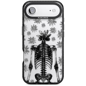 Skeleton Flower